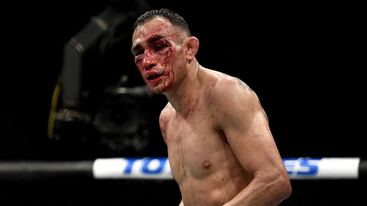 Tony Ferguson Biography